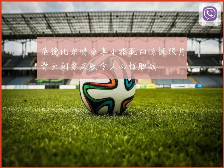 范德比尔特分享小指脱臼惊悚照片骨头刺穿皮肤令人心惊胆战